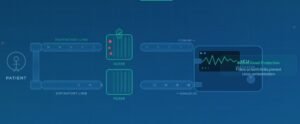 Breathing_Circuit_Infographic